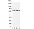 Protein Tyrosine Phosphatase Non-Receptor Type 11 antibody, R30959, NSJ Bioreagents, Western Blot image 