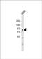 Sushi domain-containing protein 2 antibody, PA5-71776, Invitrogen Antibodies, Western Blot image 