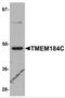 Transmembrane Protein 184C antibody, 5685, ProSci, Western Blot image 