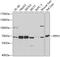 Ribophorin I antibody, 14-462, ProSci, Western Blot image 