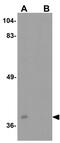 Basic Leucine Zipper ATF-Like Transcription Factor 3 antibody, GTX31933, GeneTex, Western Blot image 