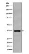 RAD51 Recombinase antibody, M00088, Boster Biological Technology, Western Blot image 