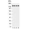 Laminin Subunit Gamma 2 antibody, R30659, NSJ Bioreagents, Western Blot image 