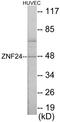 Zinc Finger Protein 24 antibody, EKC1679, Boster Biological Technology, Western Blot image 