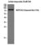 Neurogenic locus notch homolog protein 2 antibody, GTX86904, GeneTex, Western Blot image 