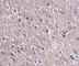 Cell Death Inducing P53 Target 1 antibody, NBP1-76993, Novus Biologicals, Immunohistochemistry frozen image 