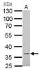B- and T-lymphocyte attenuator antibody, PA5-22248, Invitrogen Antibodies, Western Blot image 