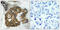 AKT Serine/Threonine Kinase 2 antibody, LS-C117288, Lifespan Biosciences, Immunohistochemistry frozen image 