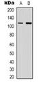 Phosphatidylinositol-4,5-Bisphosphate 3-Kinase Catalytic Subunit Gamma antibody, LS-B14571, Lifespan Biosciences, Western Blot image 