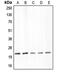 Claudin 4 antibody, MBS820456, MyBioSource, Western Blot image 