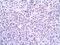 Snail Family Transcriptional Repressor 2 antibody, NBP2-03886, Novus Biologicals, Immunohistochemistry frozen image 