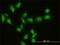 GIT ArfGAP 2 antibody, H00009815-M01, Novus Biologicals, Immunocytochemistry image 