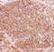 Nuclear Factor Kappa B Subunit 2 antibody, LS-C344010, Lifespan Biosciences, Immunohistochemistry paraffin image 