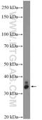 Ventral Anterior Homeobox 2 antibody, 15773-1-AP, Proteintech Group, Western Blot image 