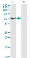 Aldehyde Dehydrogenase 1 Family Member A1 antibody, LS-B6003, Lifespan Biosciences, Western Blot image 