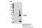 Triggering Receptor Expressed On Myeloid Cells 2 antibody, 91068S, Cell Signaling Technology, Immunoprecipitation image 