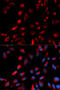 Carboxypeptidase E antibody, 19-677, ProSci, Immunofluorescence image 