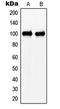 NEDD4 Binding Protein 1 antibody, LS-C353189, Lifespan Biosciences, Western Blot image 