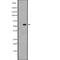 Zinc Finger Protein 71 antibody, abx149494, Abbexa, Western Blot image 