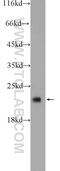 COMM Domain Containing 8 antibody, 25237-1-AP, Proteintech Group, Western Blot image 