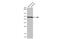 LIM Homeobox 1 antibody, GTX129215, GeneTex, Western Blot image 