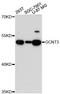 Glucosaminyl (N-Acetyl) Transferase 3, Mucin Type antibody, A13209, ABclonal Technology, Western Blot image 