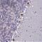 Chromosome 2 Open Reading Frame 49 antibody, PA5-60535, Invitrogen Antibodies, Immunohistochemistry frozen image 