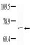 Non-receptor tyrosine-protein kinase TNK1 antibody, AP14482PU-N, Origene, Western Blot image 