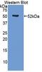 Erythropoietin Receptor antibody, LS-C372400, Lifespan Biosciences, Western Blot image 