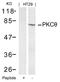 Protein Kinase C Theta antibody, 79-353, ProSci, Western Blot image 