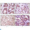 Inhibitor Of Nuclear Factor Kappa B Kinase Subunit Beta antibody, LS-C812801, Lifespan Biosciences, Immunohistochemistry paraffin image 