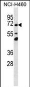 Transmembrane Protein 181 antibody, PA5-71695, Invitrogen Antibodies, Western Blot image 