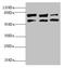 Kinesin Family Member 3A antibody, LS-C675946, Lifespan Biosciences, Western Blot image 