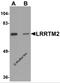 Leucine Rich Repeat Transmembrane Neuronal 2 antibody, 6169, ProSci, Western Blot image 