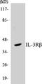 Colony Stimulating Factor 2 Receptor Beta Common Subunit antibody, EKC1299, Boster Biological Technology, Western Blot image 