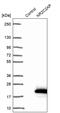 Nuclear Receptor 2C2 Associated Protein antibody, PA5-59846, Invitrogen Antibodies, Western Blot image 