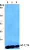 Mitochondrially Encoded ATP Synthase Membrane Subunit 8 antibody, A06405, Boster Biological Technology, Western Blot image 