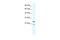 Tripartite Motif Containing 14 antibody, 28-179, ProSci, Western Blot image 