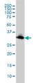 Emerin antibody, H00002010-M01, Novus Biologicals, Western Blot image 