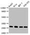Cyclin Dependent Kinase Inhibitor 1B antibody, CSB-RA005087A0HU, Cusabio, Western Blot image 