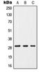 Cytokine Inducible SH2 Containing Protein antibody, LS-C352004, Lifespan Biosciences, Western Blot image 
