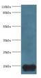 MLC-2 antibody, LS-C371939, Lifespan Biosciences, Western Blot image 