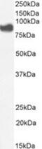 Phospholipase A2 Group IVA antibody, NBP1-52050, Novus Biologicals, Western Blot image 