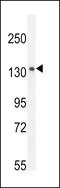 Cell Migration Inducing Hyaluronidase 1 antibody, LS-C165387, Lifespan Biosciences, Western Blot image 