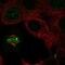 Inner Centromere Protein antibody, NBP2-57266, Novus Biologicals, Immunocytochemistry image 