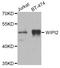 WD Repeat Domain, Phosphoinositide Interacting 2 antibody, A06492-1, Boster Biological Technology, Western Blot image 