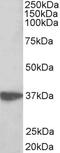 Protein Arginine Methyltransferase 3 antibody, 43-047, ProSci, Western Blot image 