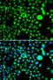 NADH:Ubiquinone Oxidoreductase Complex Assembly Factor 5 antibody, orb247823, Biorbyt, Immunofluorescence image 