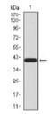 Neurotrophic Receptor Tyrosine Kinase 2 antibody, NBP2-52524, Novus Biologicals, Western Blot image 