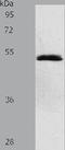 Secretin Receptor antibody, TA322923, Origene, Western Blot image 